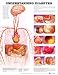 Diabetes Chart Understanding Diabetes