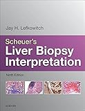 Scheuer's liver biopsy interpretation