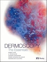 Dermoscopy: The Essentials