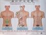 Abdominal Acupuncture Points Wall Chart