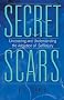 Secret Scars: Uncovering and Understanding the Addiction of Self-injury