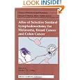 Atlas of Selective Sentinel Lymphadenectomy for Melanoma, Breast Cancer and Colon Cancer (Cancer... by Stanley P.L. Leong