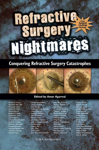 Refractive Surgery Nightmares: Conquering Refractive Surgery Catastrophes
