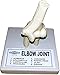 Herindera Human Elbow Joint RS.400.00