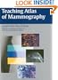 Teaching Atlas of Mammography