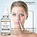 Skinology Cosmeceuticals Organic Anti Acne Serum for face, 1 oz