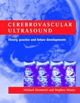 Cerebrovascular Ultrasound: Theory, Practice and Future Developments