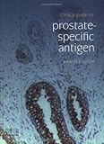 Clinical Guide to Prostate-Specific Antigen