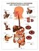 Gastroesophageal Disorders Anatomical Chart Laminated