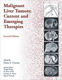 Malignant Liver Tumors: Current and Emerging Therapies