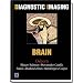 Neurology