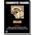 Diagnostic Imaging: Brain by  Anne Osborn, Susan Blaser, and Karen Salzman