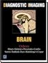 Diagnostic Imaging: Brain