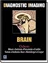 Diagnostic Imaging: Brain