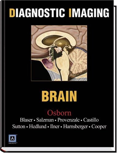 Diagnostic Imaging: Brain