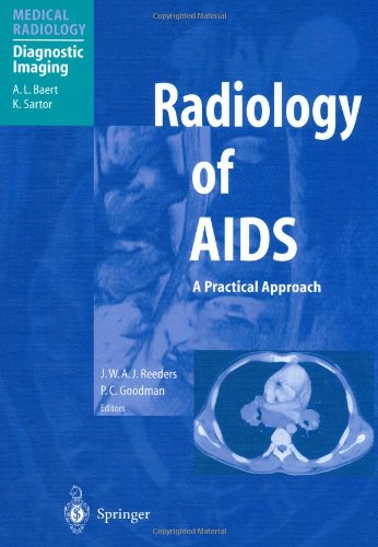 Radiology of AIDS (Medical Radiology / Diagnostic Imaging)