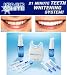Ionic White Light Activated Tooth Whitening System