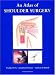 Search : An Atlas of Shoulder Surgery