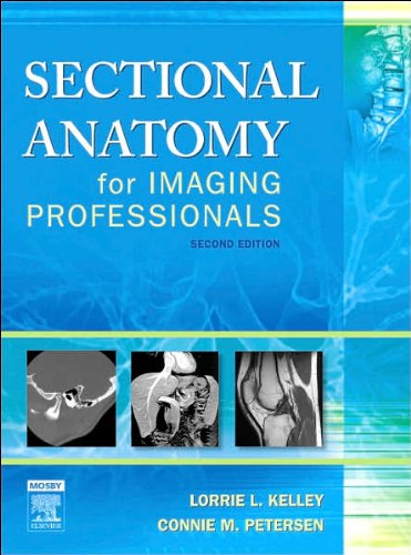 L. L. Kelley MS RT(R)'s C. Petersen MS RT(R)'s Sectional Anatomy 2nd(Second) edition(Sectional Anatomy for Imaging Professionals [Hardcover])(2007)