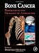 Bone Cancer: Progression and Therapeutic Approaches