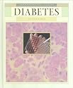 Diabetes (Understanding Illness)