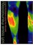 Soft Tissue Rheumatology (Oxford Medical Publications)
