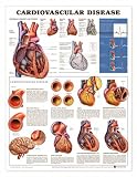 Chart - Cardiovascular Disease