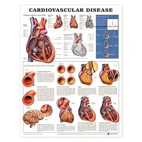 Lww Cardiovascular Disease 2nd Edition Anatomical Chart Laminated-9915PL1.5 by 