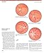 The Netter Collection of Medical Illustrations: Cardiovascular System: Volume 8 (Netter Green Book Collection)