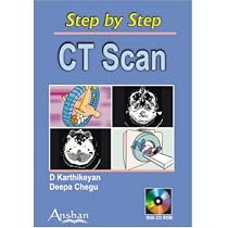CT Scan (Step by Step)