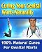 51VdEdWVrVL. SL75  Natural And Good Ways Of Genital Wart Cures