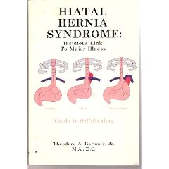 Hiatal Hernia Syndrome by 