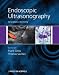 Endoscopic Ultrasonography