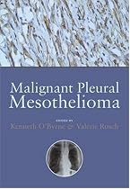 Malignant Pleural Mesothelioma