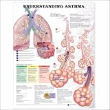 Understanding Asthma Anatomical Chart