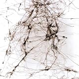 Cognitive Decline