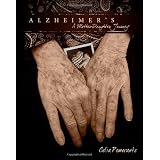 Alzheimer's: A Mother-Daughter Journey