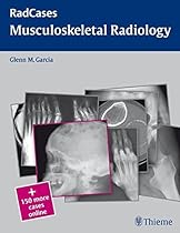 Musculoskeletal Radiology (RadCases) Musculoskeletal Radiology (RadCases)