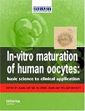 In Vitro Maturation of Human Oocytes: Basic Science to Clinical Applications (Reproductive Medicine and Asst. Reproduction)