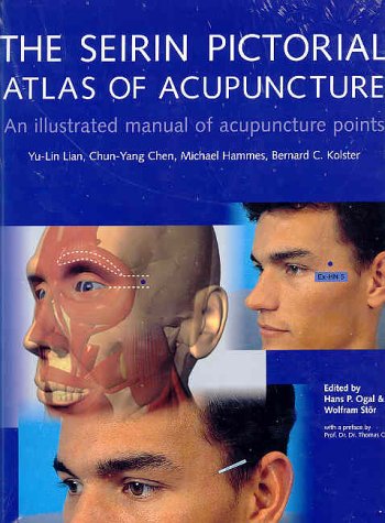 Acupuncture