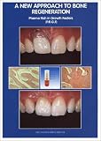 A New Approach to Bone Regeneration: Plasma Rich in Growth Factors