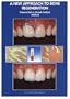 A New Approach to Bone Regeneration: Plasma Rich in Growth Factors (PRGF)