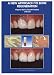 Book A New Approach to Bone Regeneration: Plasma Rich in Growth Factors (PRGF)
