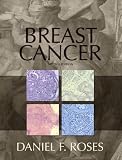 Breast Cancer