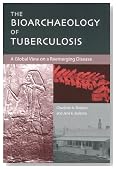 The Bioarchaeology of Tuberculosis: A Global View on a Reemerging Disease