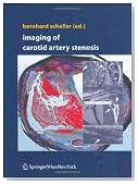 Imaging of Carotid Artery Stenosis