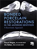 Bonded Porcelain Restorations in the Anterior Dentition: A Biomimetic Approach