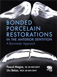 Bonded Porcelain Restorations in the Anterior Dentition: A Biomimetic Approach