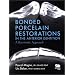 Bonded Porcelain Restorations in the Anterior Dentition: A Biomimetic Approach