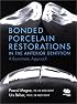 Bonded Porcelain Restorations in the Anterior Dentition: A Biomimetic Approach